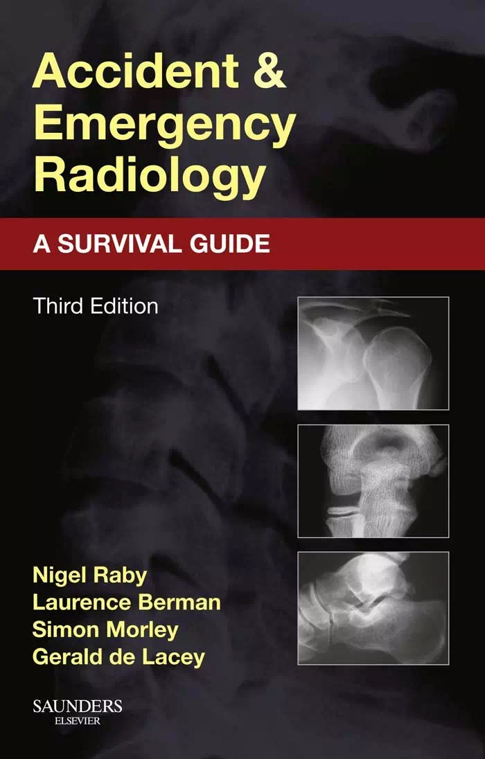 Accident and Emergency Radiology - A Survival Guide - Nigel Raby